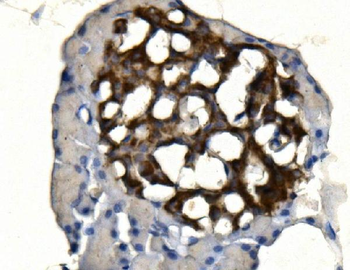 Synaptophysin/SYP Rabbit Polyclonal Antibody