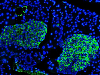 Synaptophysin/SYP Rabbit Polyclonal Antibody