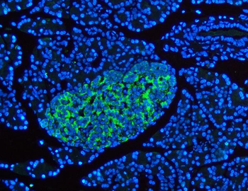 Synaptophysin/SYP Rabbit Polyclonal Antibody