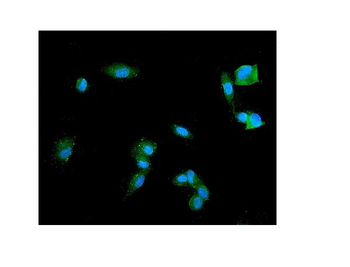 Synaptophysin/SYP Rabbit Polyclonal Antibody
