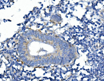 Synaptophysin/SYP Rabbit Polyclonal Antibody