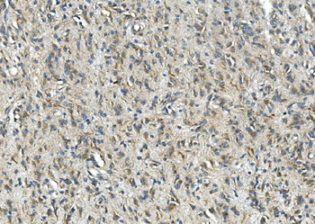 Synaptophysin/SYP Rabbit Polyclonal Antibody