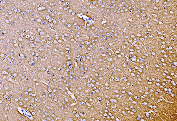 Synaptophysin/SYP Rabbit Polyclonal Antibody