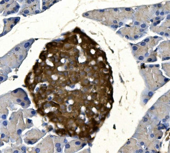 Synaptophysin/SYP Rabbit Polyclonal Antibody