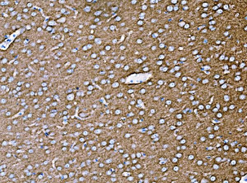Synaptophysin/SYP Rabbit Polyclonal Antibody