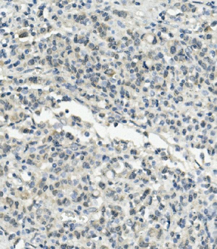 UBE3A Rabbit Polyclonal Antibody