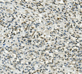 UBE3A Rabbit Polyclonal Antibody