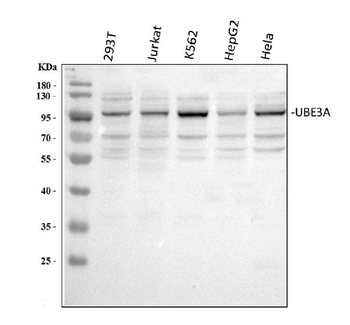 UBE3A Rabbit Polyclonal Antibody