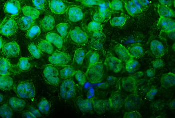 UBR2 Rabbit Polyclonal Antibody