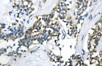 UBR2 Rabbit Polyclonal Antibody