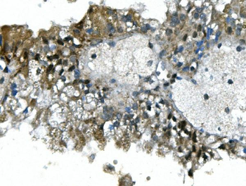 UBR2 Rabbit Polyclonal Antibody