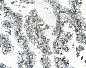 UBR2 Rabbit Polyclonal Antibody