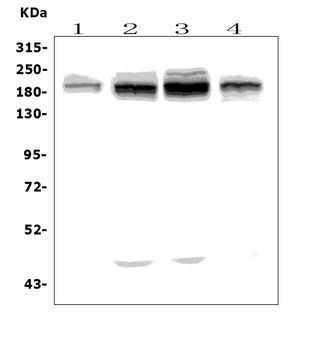 UBR2 Rabbit Polyclonal Antibody