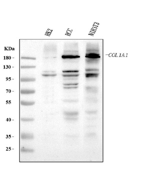 Collagen I/COL1A1 Rabbit Polyclonal Antibody
