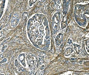 Collagen I/COL1A1 Rabbit Polyclonal Antibody