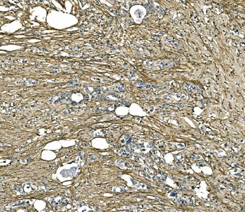 Collagen I/COL1A1 Rabbit Polyclonal Antibody