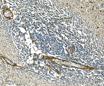 Collagen I/COL1A1 Rabbit Polyclonal Antibody