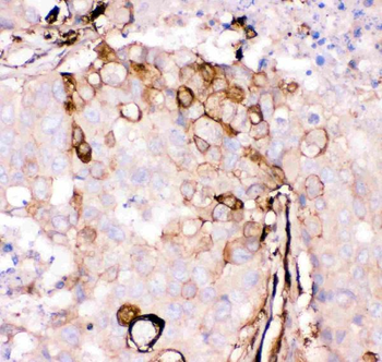 Gelsolin/GSN Rabbit Polyclonal Antibody