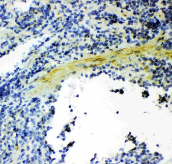 Gelsolin/GSN Rabbit Polyclonal Antibody