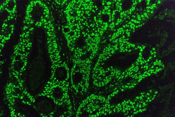 KAP1/TRIM28 Mouse Monoclonal Antibody