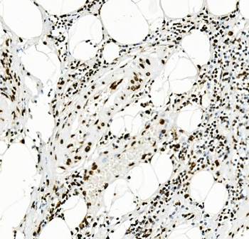 KAP1/TRIM28 Mouse Monoclonal Antibody
