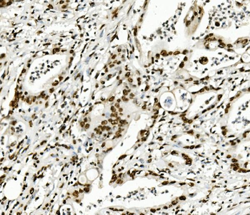 KAP1/TRIM28 Mouse Monoclonal Antibody
