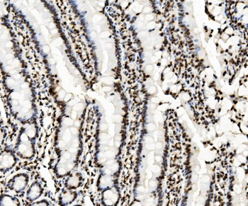 KAP1/TRIM28 Mouse Monoclonal Antibody
