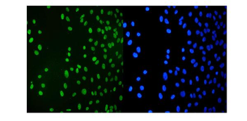 KAP1/TRIM28 Mouse Monoclonal Antibody