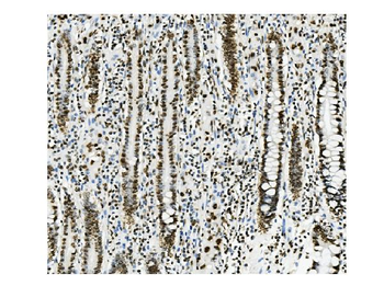 KAP1/TRIM28 Mouse Monoclonal Antibody