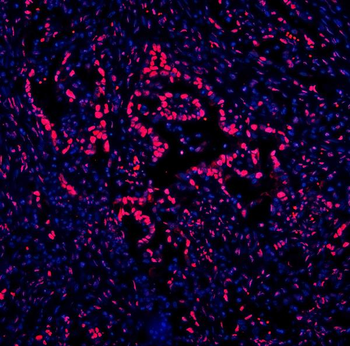 DDX5 Mouse Monoclonal Antibody