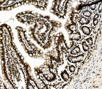 DDX5 Mouse Monoclonal Antibody