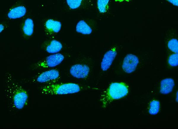 Ribonuclease Inhibitor/RNH1 Mouse Monoclonal Antibody