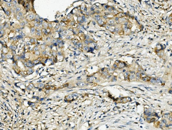 Ribonuclease Inhibitor/RNH1 Mouse Monoclonal Antibody