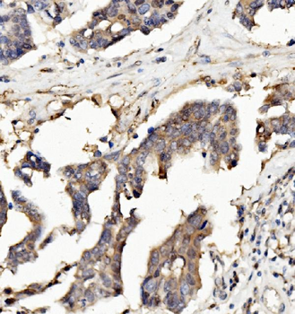 Ribonuclease Inhibitor/RNH1 Mouse Monoclonal Antibody