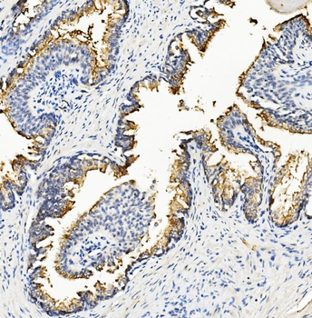 Ribonuclease Inhibitor/RNH1 Mouse Monoclonal Antibody