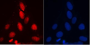 RENT1/hUPF1 Mouse Monoclonal Antibody