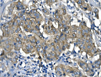 RENT1/hUPF1 Mouse Monoclonal Antibody