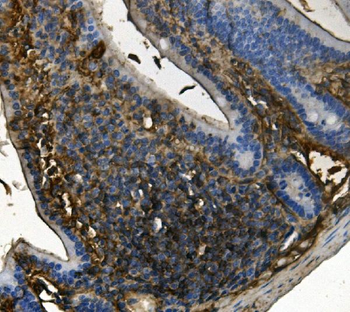 RENT1/hUPF1 Mouse Monoclonal Antibody