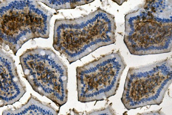 RENT1/hUPF1 Mouse Monoclonal Antibody