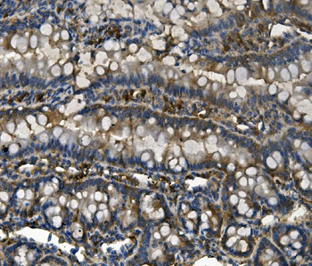 RENT1/hUPF1 Mouse Monoclonal Antibody
