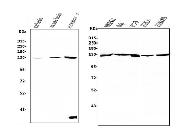RENT1/hUPF1 Mouse Monoclonal Antibody