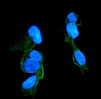 CCR2 Mouse Monoclonal Antibody