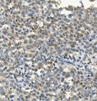 CCR2 Mouse Monoclonal Antibody