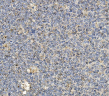 CCR2 Mouse Monoclonal Antibody
