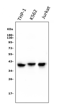 CCR2 Mouse Monoclonal Antibody