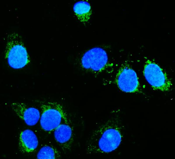 Hexokinase 1/HK1 Mouse Monoclonal Antibody