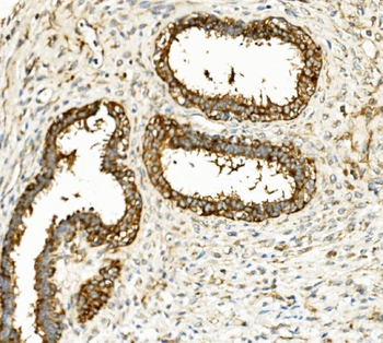 Hexokinase 1/HK1 Mouse Monoclonal Antibody