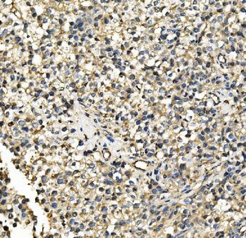 Hexokinase 1/HK1 Mouse Monoclonal Antibody