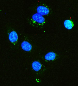 Hexokinase 1/HK1 Mouse Monoclonal Antibody