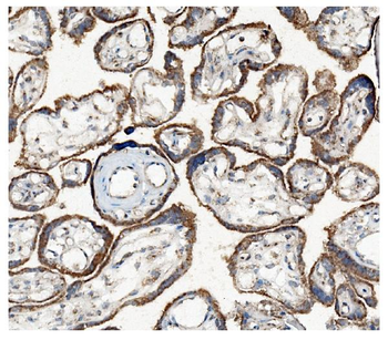 Hexokinase 1/HK1 Mouse Monoclonal Antibody